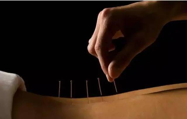 平衡針灸最新視頻，現(xiàn)代應(yīng)用探索針灸藝術(shù)的新境界