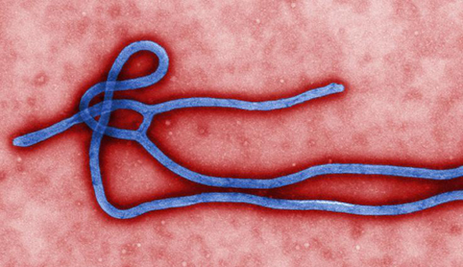 警惕最新病毒病人，你需要了解這些關(guān)鍵信息！