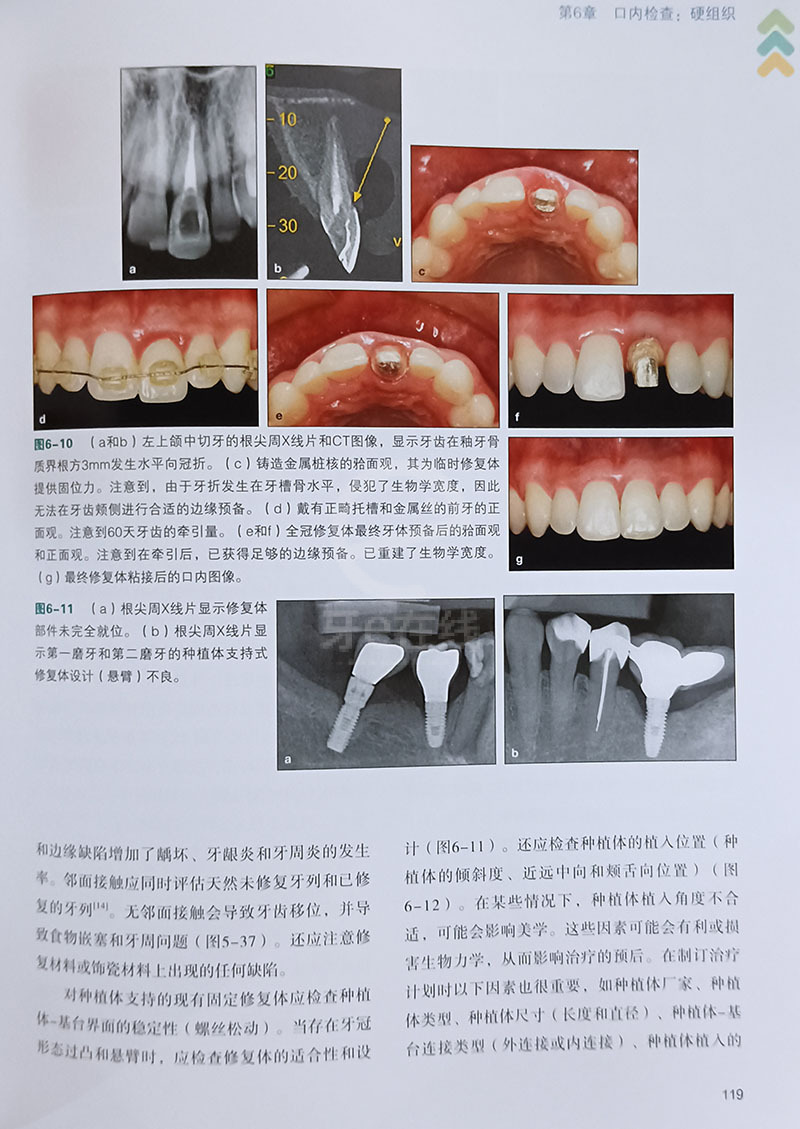 牙齒修復(fù)前沿技術(shù)觀點論述