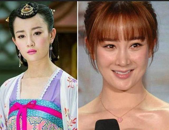 坦然面對整容，女明星的美麗新篇章之旅