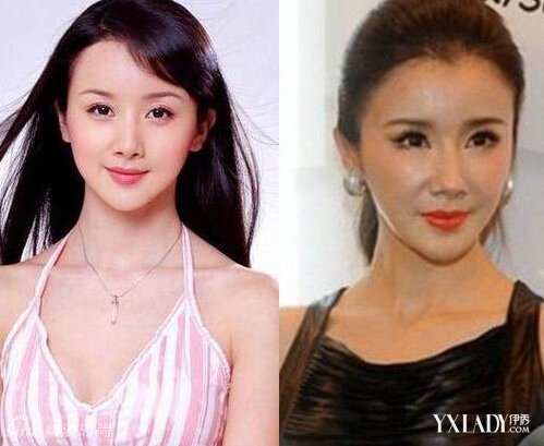 探秘明星整容的秘密，神秘美容小店的魅力所在！